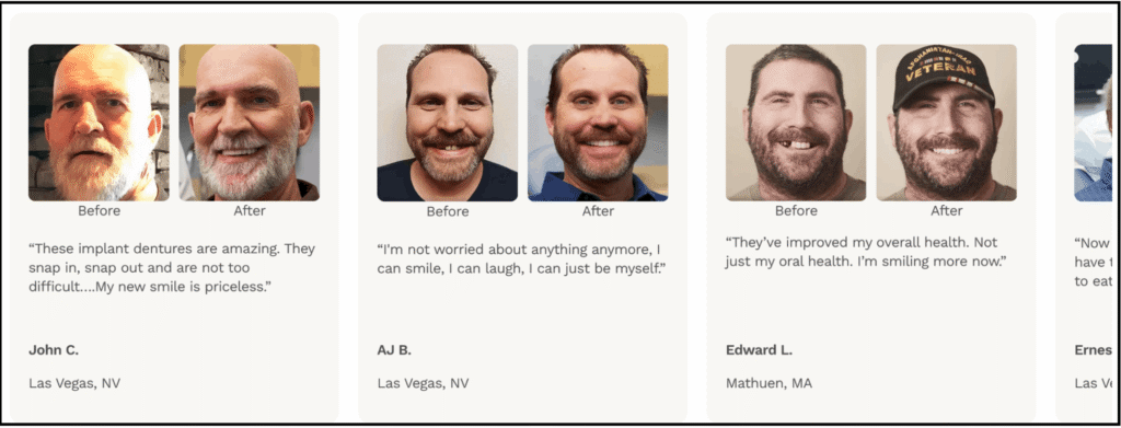 dental smile transformations